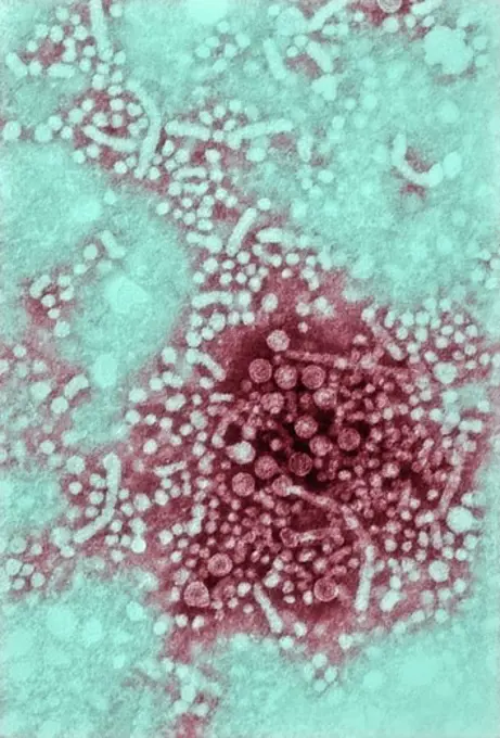 Colorized negatively-stained transmission electron micrograph of hepatitis B virus, HBV, virions, also know as Dane particles