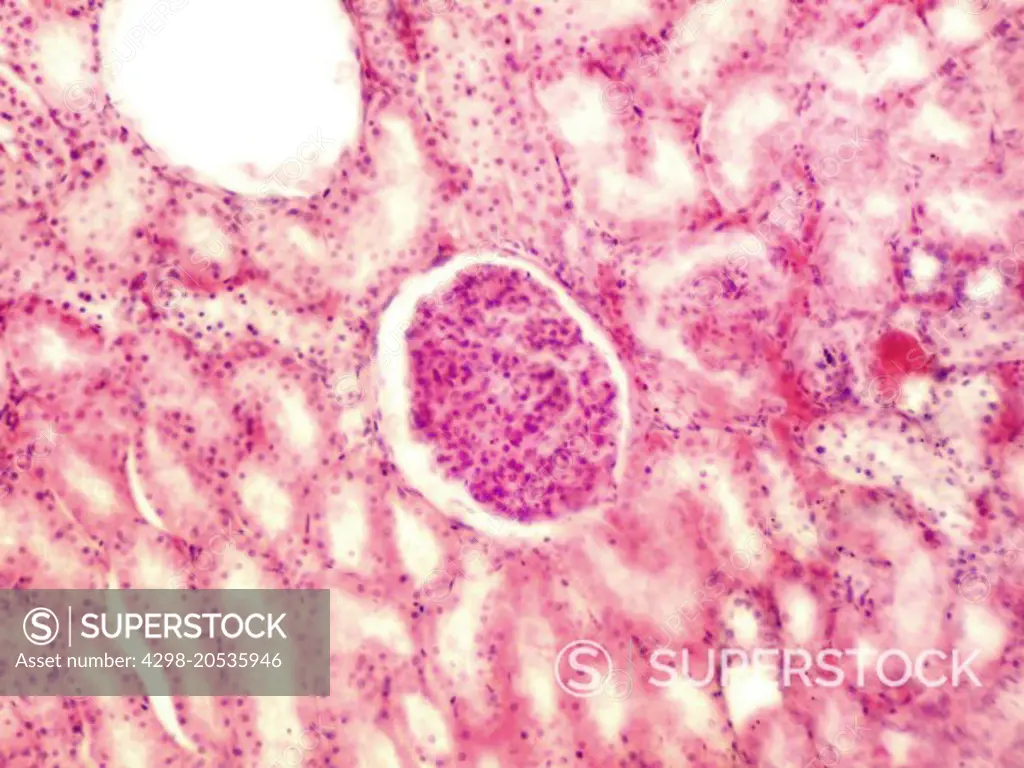 Glomerulus human kidney.  Magnification 400X