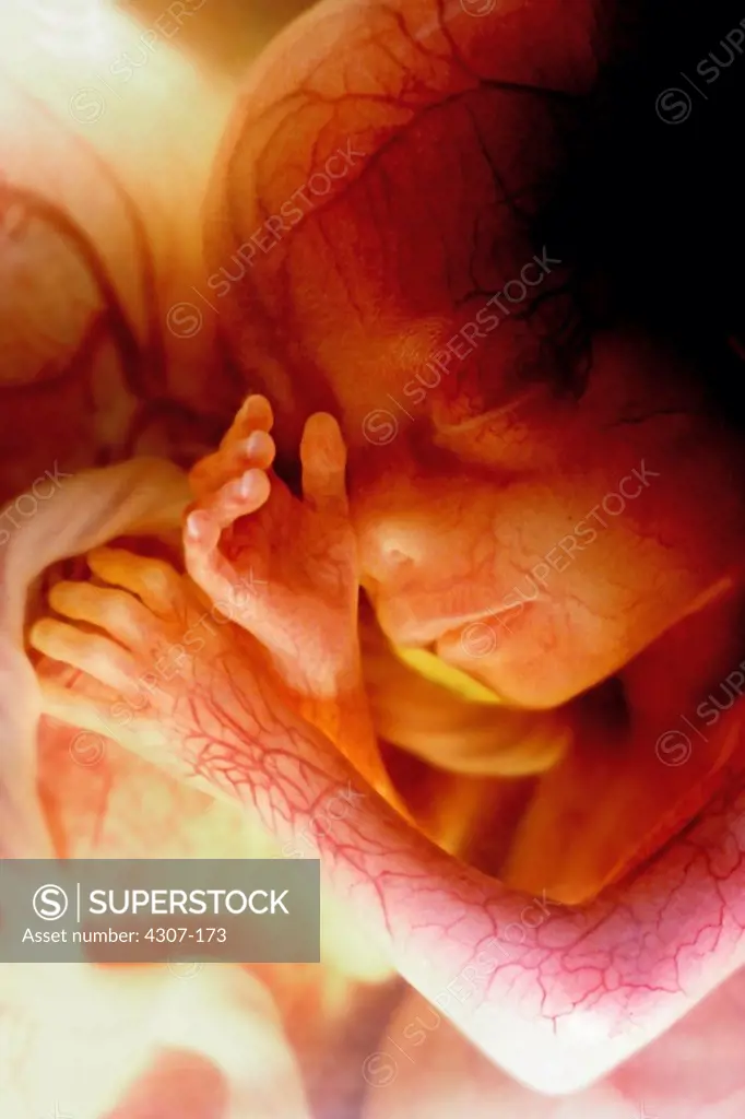 Human Life at Twenty (20) Weeks fetus