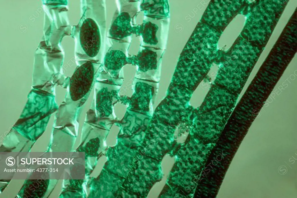 Microscopic View of Algae Plant Cells