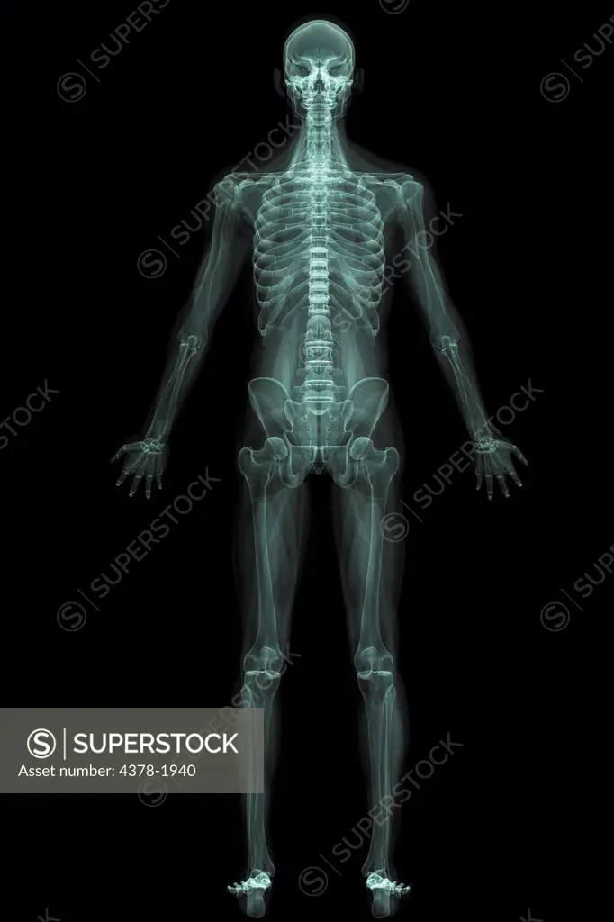 X-Ray image showing the entire human body.