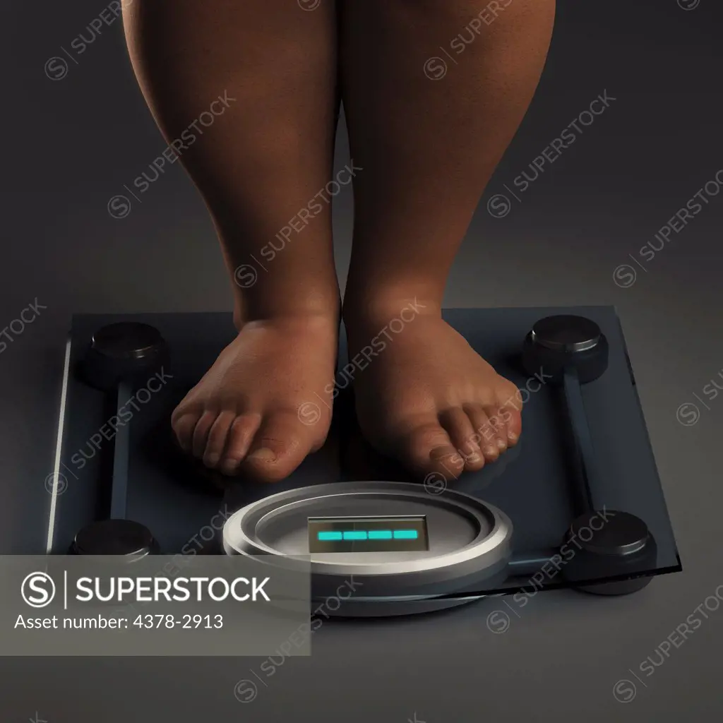 Legs and feet of an anatomical model of an obese person standing on scales.