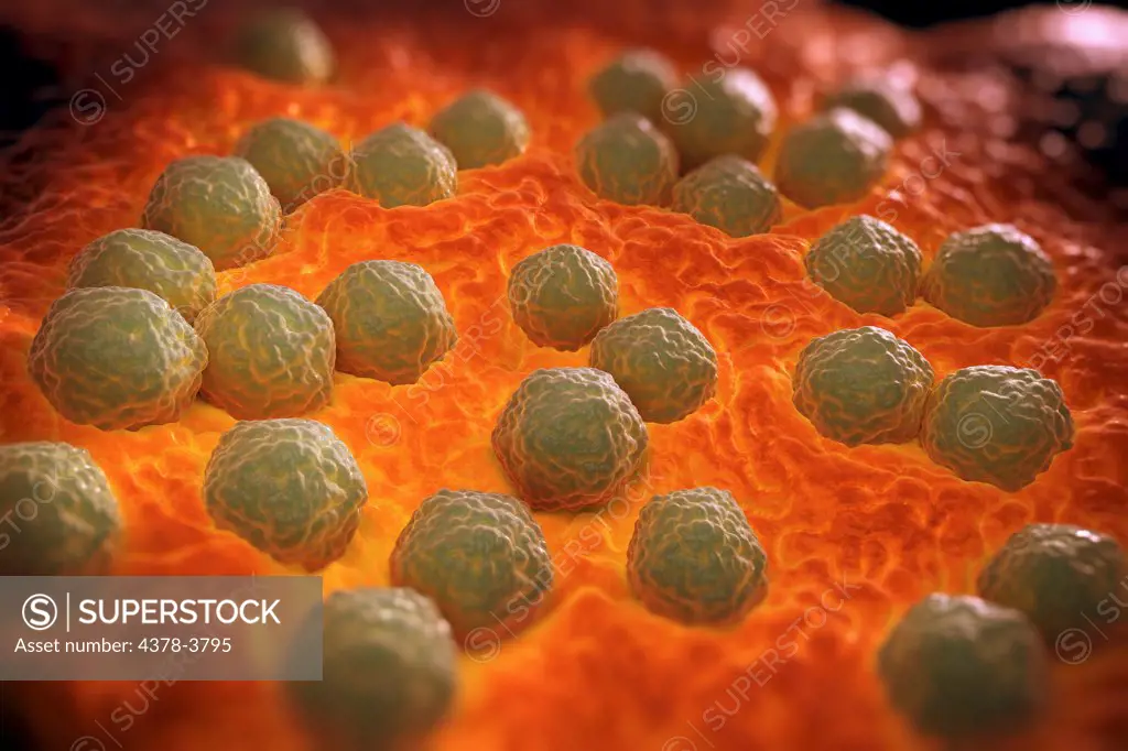 Rubella virus particles on a cellular surface. Rubella disease, commonly known as German measles, is the cause of congenital rubella syndrome when infection occurs during the first weeks of pregnancy.