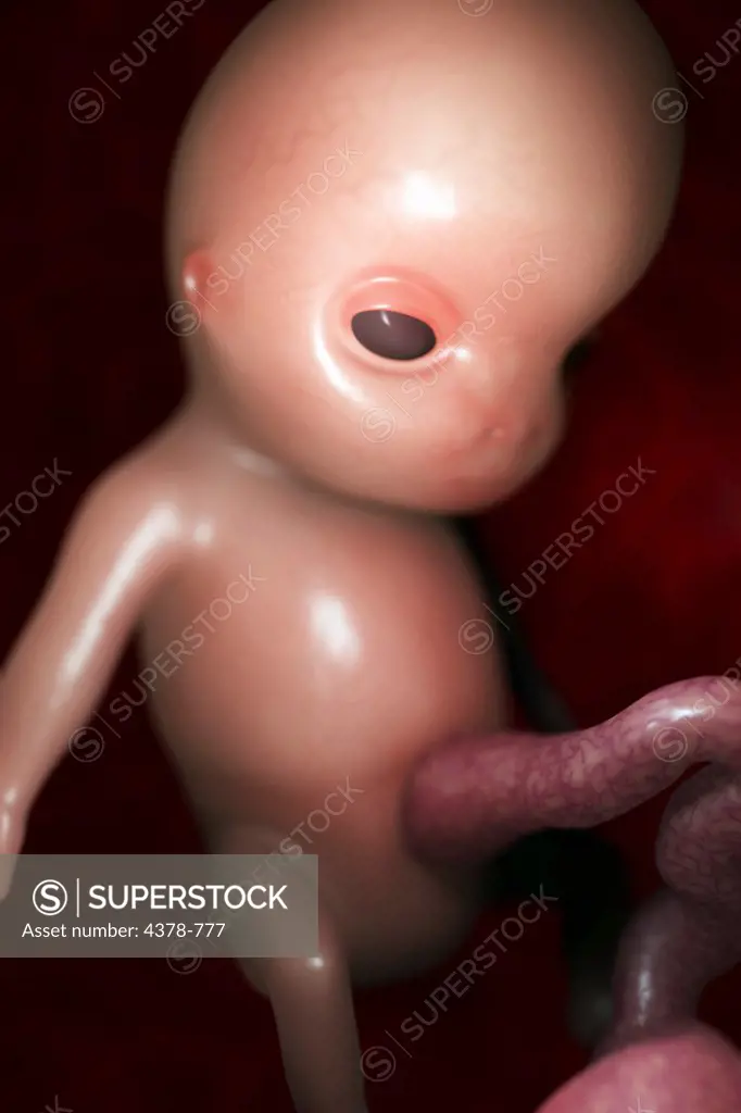 Fetus in utero (fetal development approx. week 12)