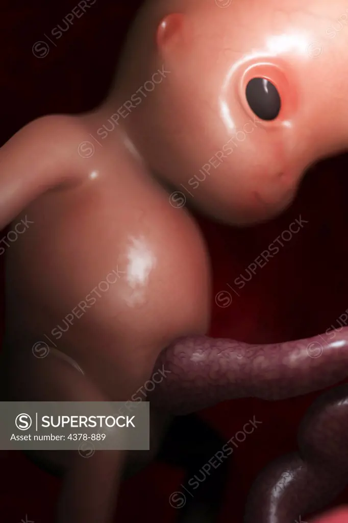 Fetus in utero (fetal development approx. week 12)