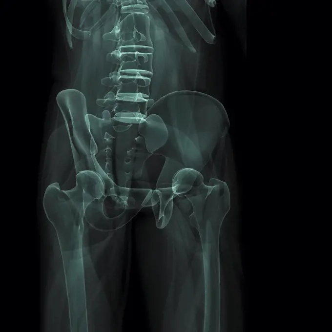 X-Ray image showing the pelvic region.