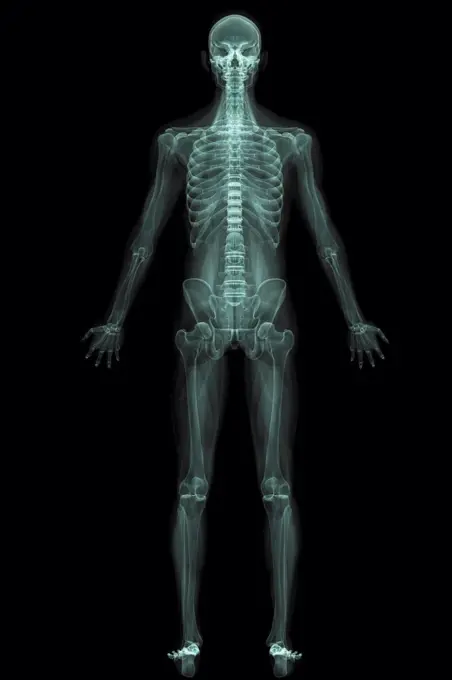 X-Ray image showing the entire human body.