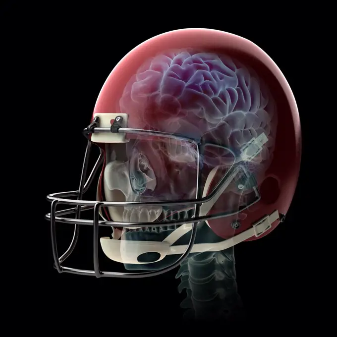 Brain Injury