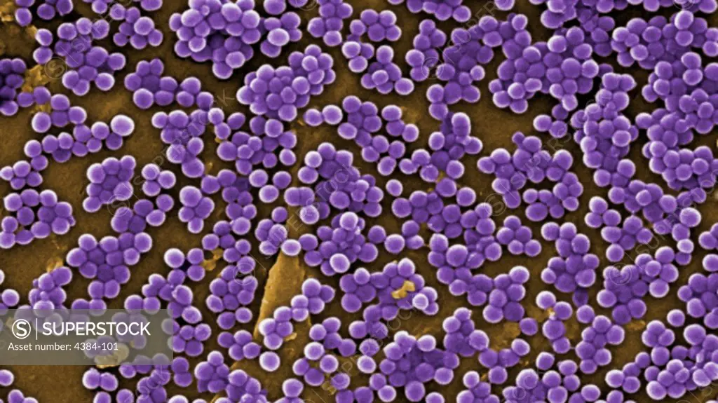 This 2005 colorized scanning electron micrograph (SEM) depicted numerous clumps of methicillin-resistant Staphylococcus aureus  bacteria, commonly referred to by the acronym, MRSA; Magnified 4780. Recently recognized outbreaks, or clusters of MRSA in community settings have been associated with strains that have some unique microbiologic and genetic properties, compared with the traditional hospital-based MRSA strains, which suggests some biologic properties, e.g., virulence factors like toxins,