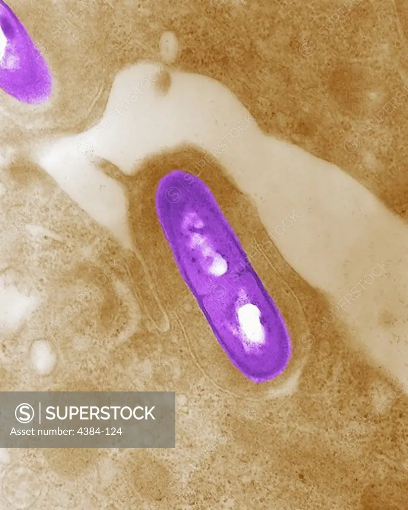 Electron micrograph of a Listeria bacterium in tissue. Listeria monocytogenes is the infectious agent responsible for the food borne illness listeriosis.  In the United States, an estimated 2,500 persons become seriously ill with listeriosis each year. Of these, 500 die.