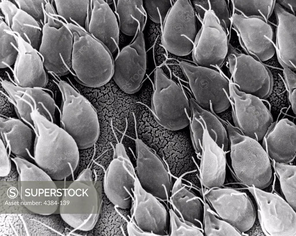 This scanning electron micrograph (SEM) depicted the mucosal surface of the small intestine of a gerbil infested with Giardia sp. protozoa.  The intestinal epithelial surface is almost entirely obscured by the attached Giardia trophozoites.  The protozoan  Giardia  causes the diarrheal disease called giardiasis.  Giardia species exist as free-swimming (by means of flagella) trophozoites, and as egg-shaped cysts. It is the cystic stage, which facilitates the survival of these organisms under hars