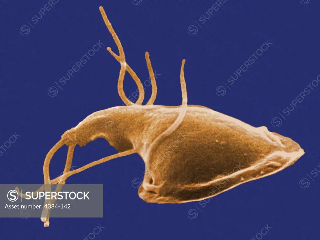 This digitally-colorized scanning electron micrograph (SEM) depicted the dorsal (upper) surface of a Giardia protozoan that had been isolated from a rats intestine. Some of the identifying morphologic characteristics include pairs of thread-like flagella that facilitate motility, and a ventolateral flange that appears as a ruffle around the anterior portion of the organism.  Pairs of flagella seen here include an anterior, posterior-lateral, and caudal pairs.  The protozoan Giardia causes the