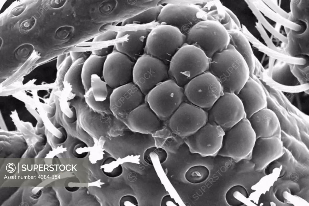 This scanning electron micrograph (SEM) revealed some of the ultrastructural morphology displayed on the head region of a bedbug, Cimex lectularius. Of interest is one of the insects compound eyes.The compound eye is given this name due to the fact that the single large eye is really made up of many repeating units known as 'ommatidia. Each ommatidium is composed of separate units made up of a photoreceptor cell, support cell, and pigment cells. Though each of these visual mechanisms functions