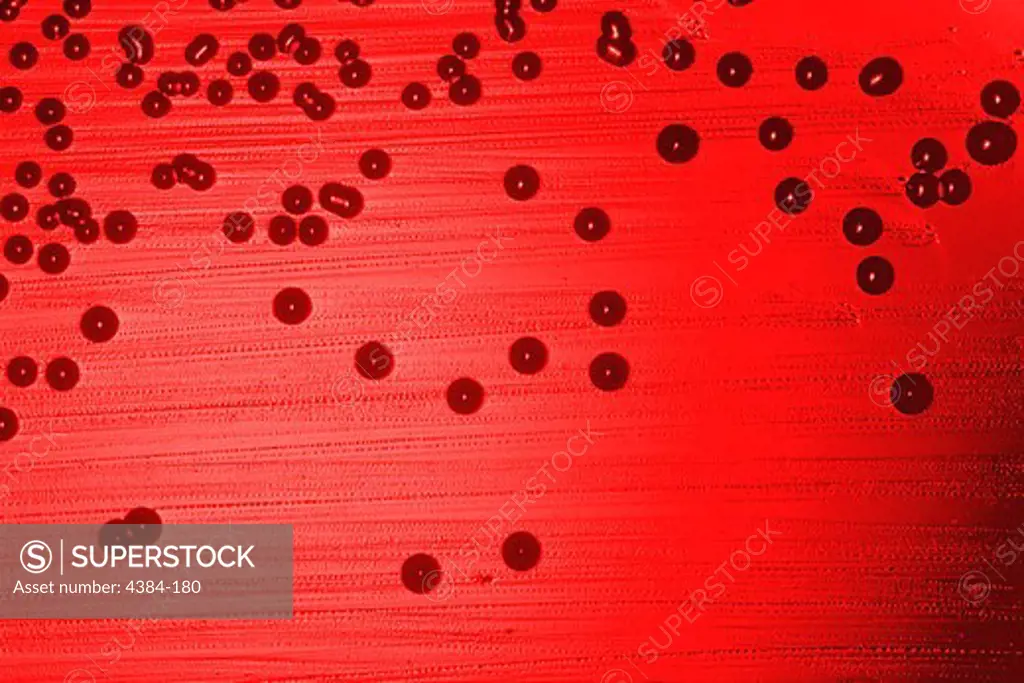 A blood ager plate culture of Haemophilus influenzae, a Gram-negative rod-shaped bacterium which until 1933 was thought to be the cause of influenza. H. influenzae is still responsible for several infections, often related to pneumonia.