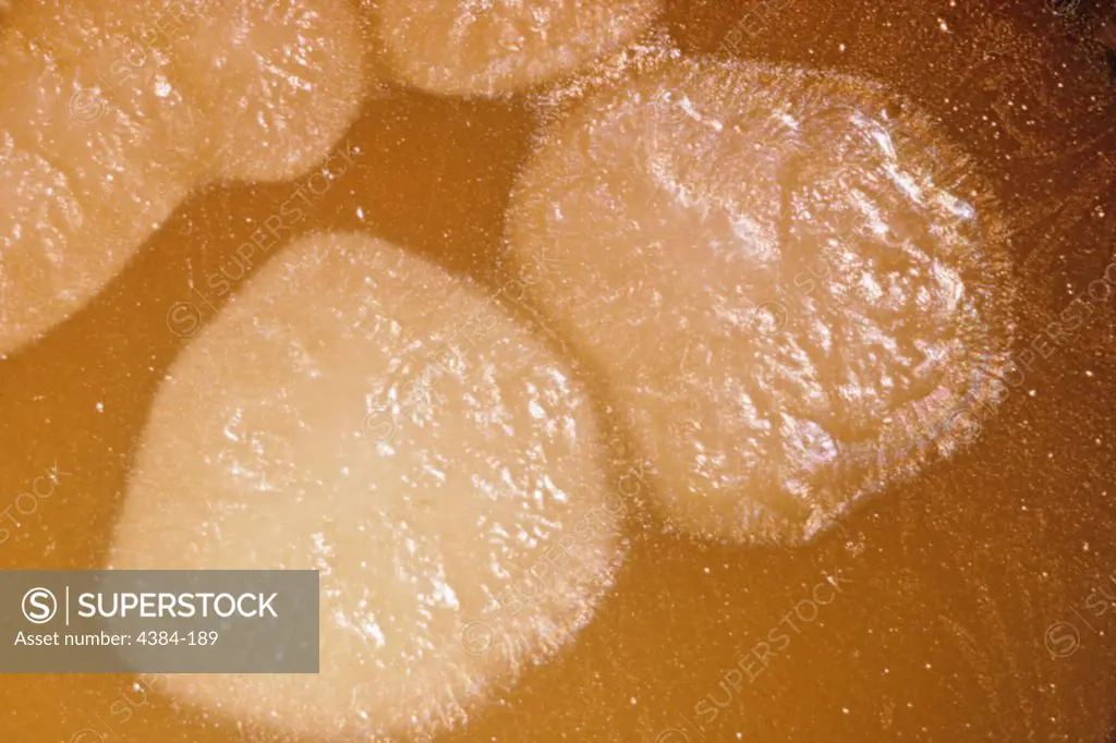 Clostridium botulinum type E opaque zone under colonies on 48 hour egg yolk agar plate (1.9X). Clostridium botulinum Type E is an indigenous organism in the aquatic environment and is the type mainly associated with botulism from seafood products. It is a Gram-positive, anaerobic, spore-forming food borne pathogen.