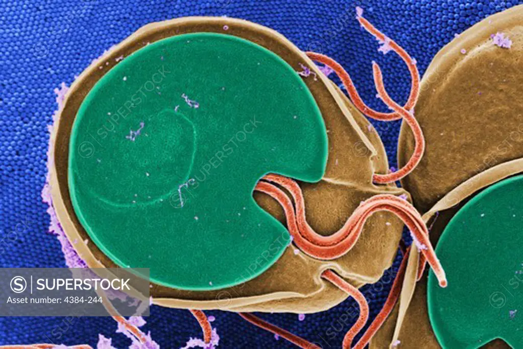 Scanning Electron Micrograph of Giardia Trophozoite