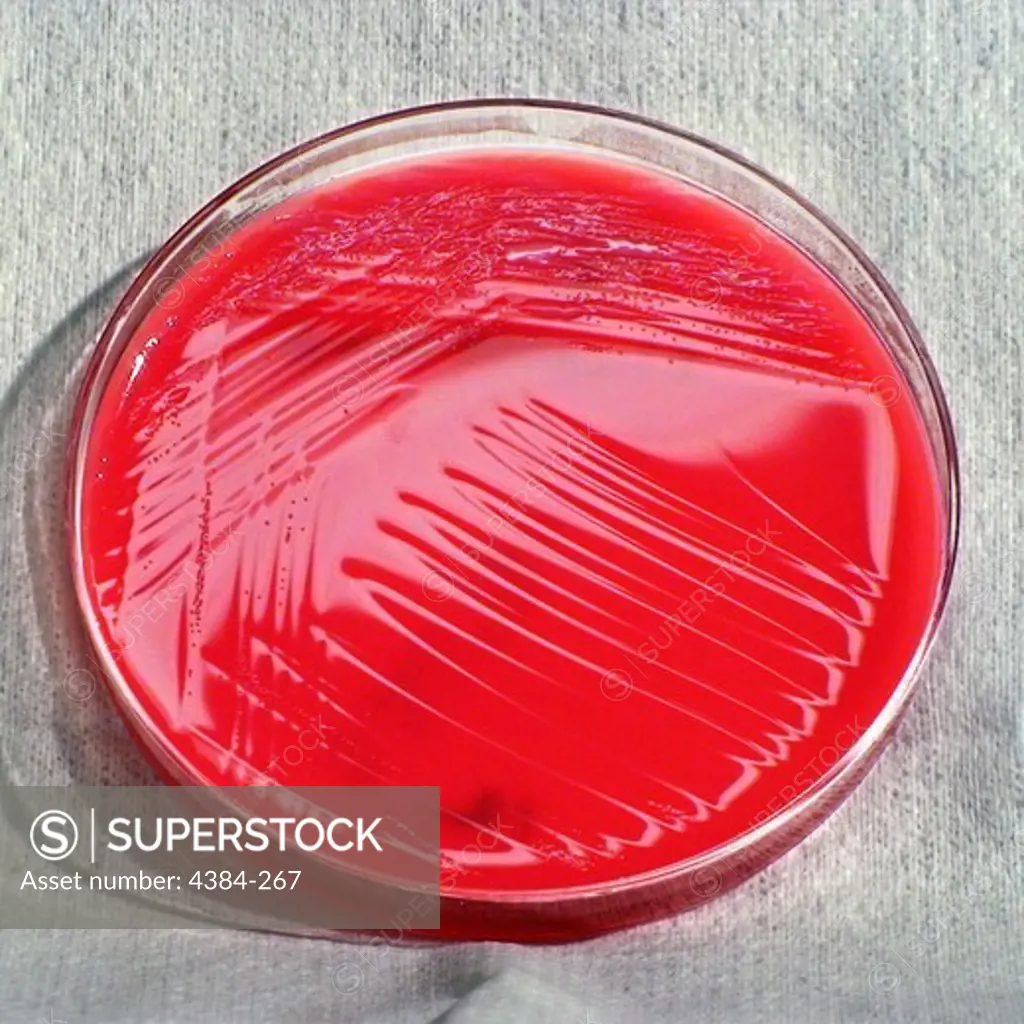 Pseudomonas fluorescens Bacterial Culture