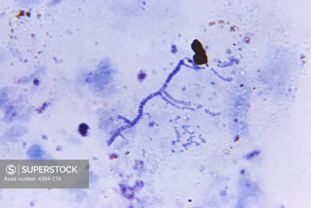 Dermatophilus congolensis Bacteria