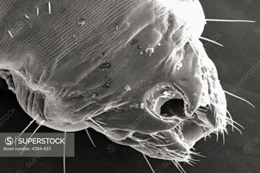 Microscopic Detail of Female Body Louse