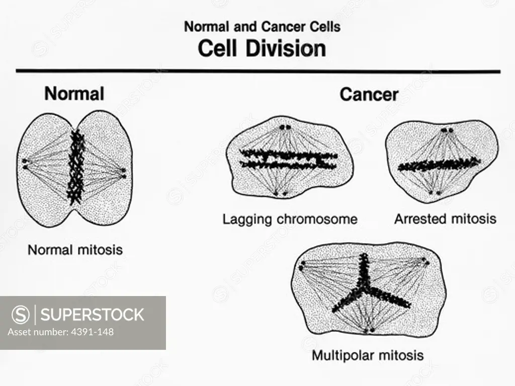 An artist's rendition of normal cells and cancer cells undergoing cell division, showing the characteristics of both. Cancer cells exhibt increased but unstructured growth.  Illustration by Pat Kenny.