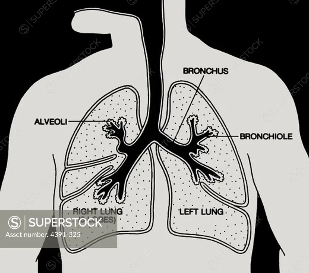 A cutaway diagram of the lungs in the chest.