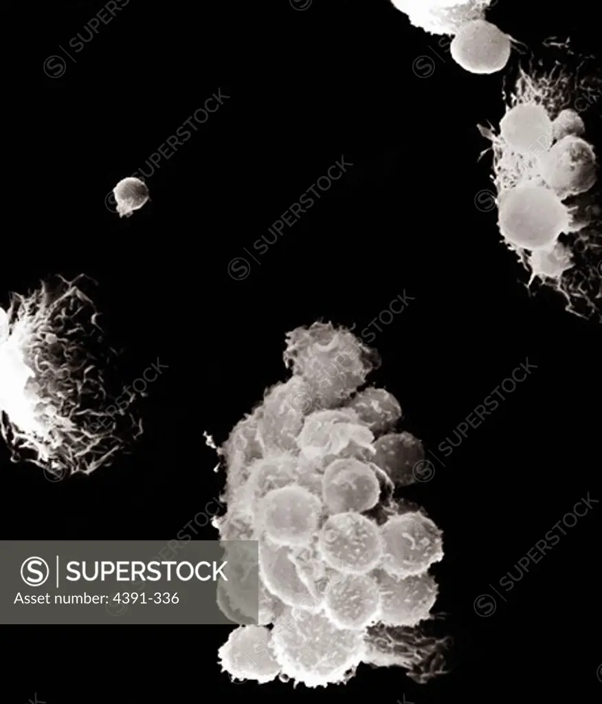 A scanning electron microscope view of macrophages and lymphocytes. The macrophages with projectile-looking surfaces are interacting with lymphocytes, which are rounded. Magnification x1040.