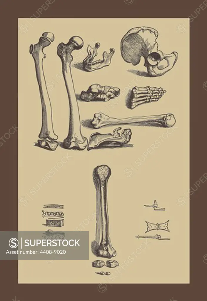 Bones with Tools, Medical - Anatomy