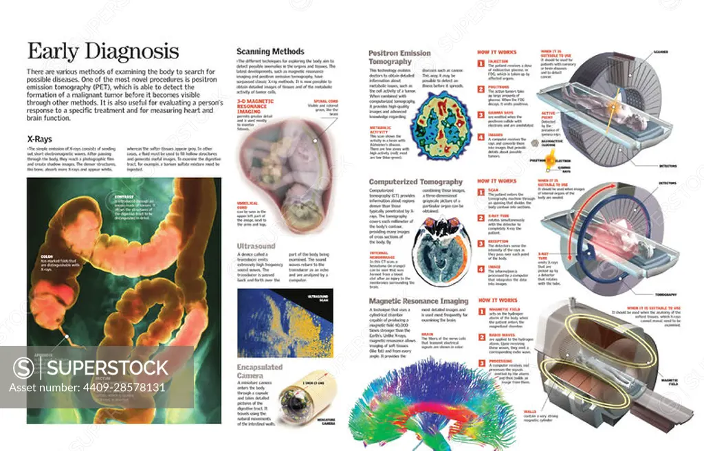 Infographic of the principal diagnostic methods used in medicine to detect and prevent possible illnesses (diseases). QuarkXPress (.qxp); 6259x4015.