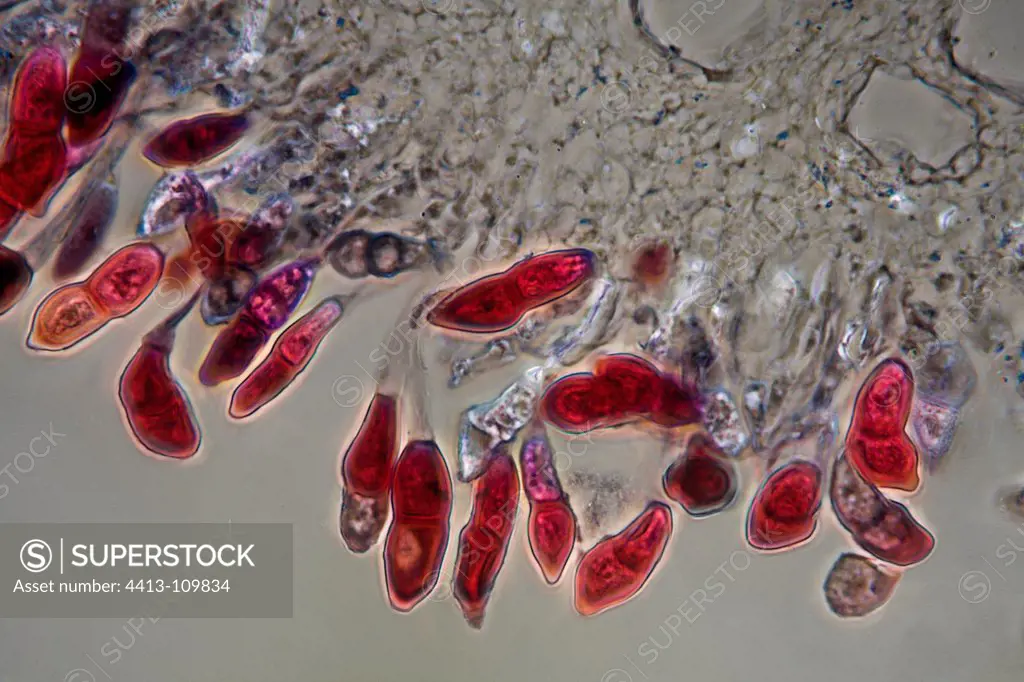 Teliospores of Puccinia on a sheet of Hollyhock