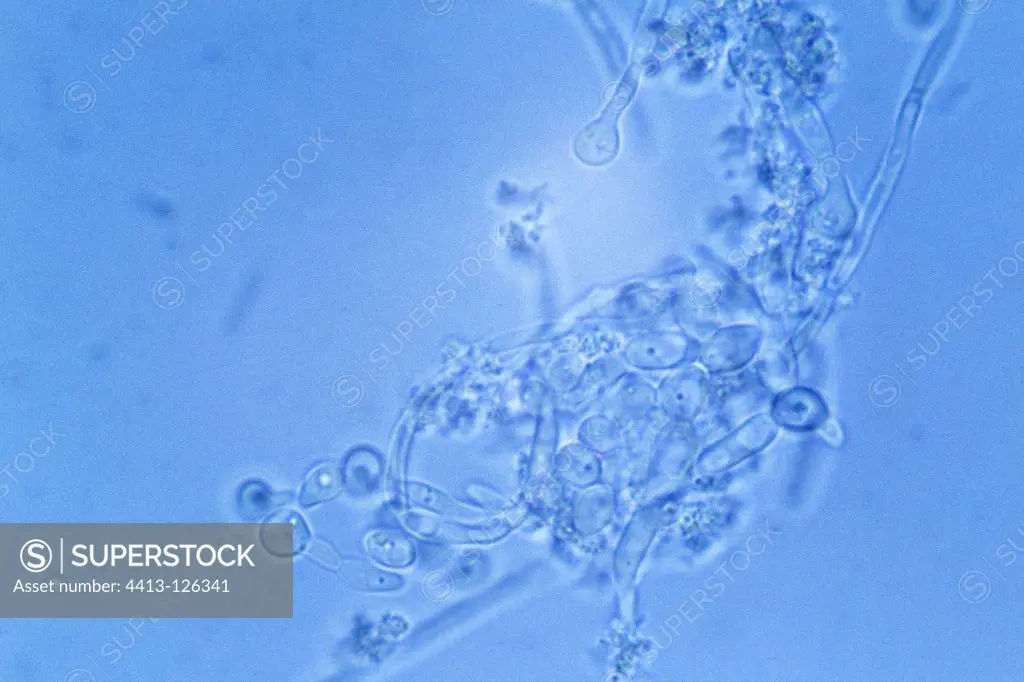 Candida optical microscope image Barcelona Spain