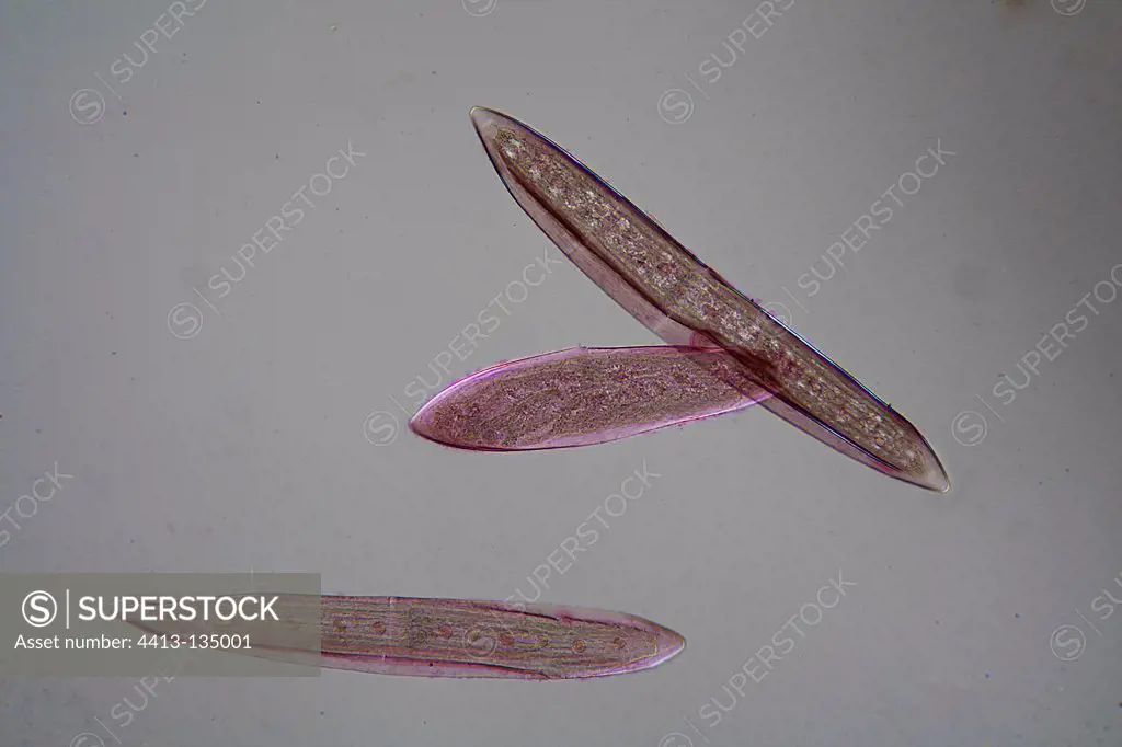 Microscopic view of Closterium acerosum Algae