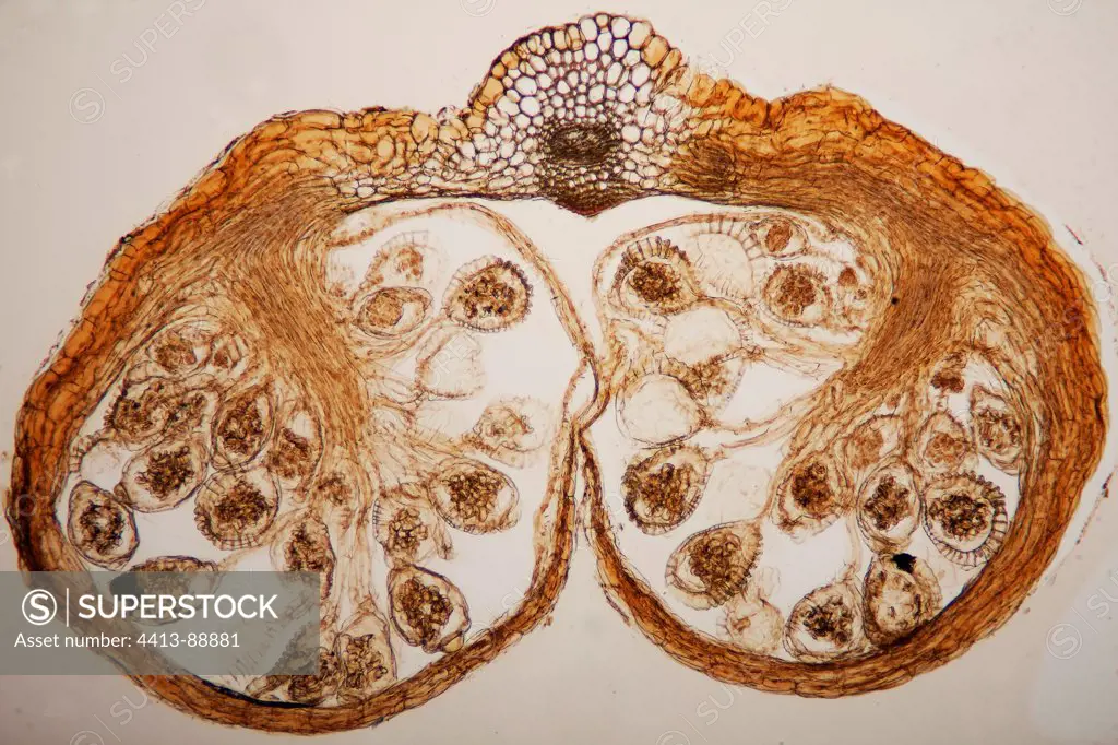 Cross section of the reproductive system of a fern