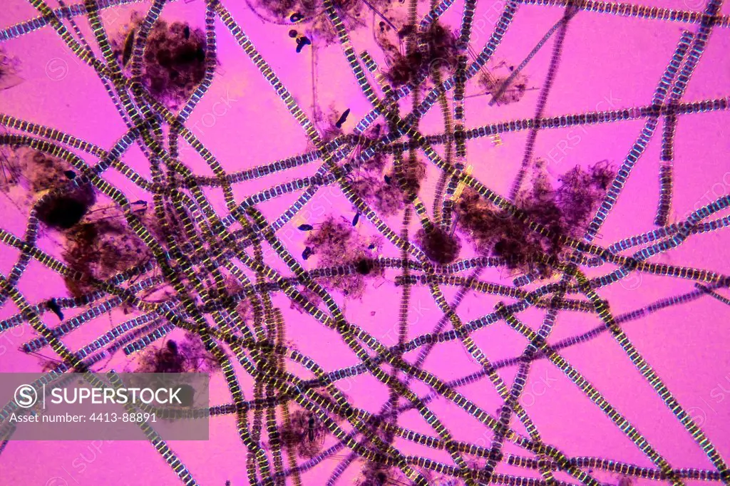 Green microalgae freshwater Desmidium