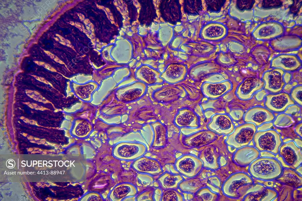 Cross section of Ascaris in the oviduct