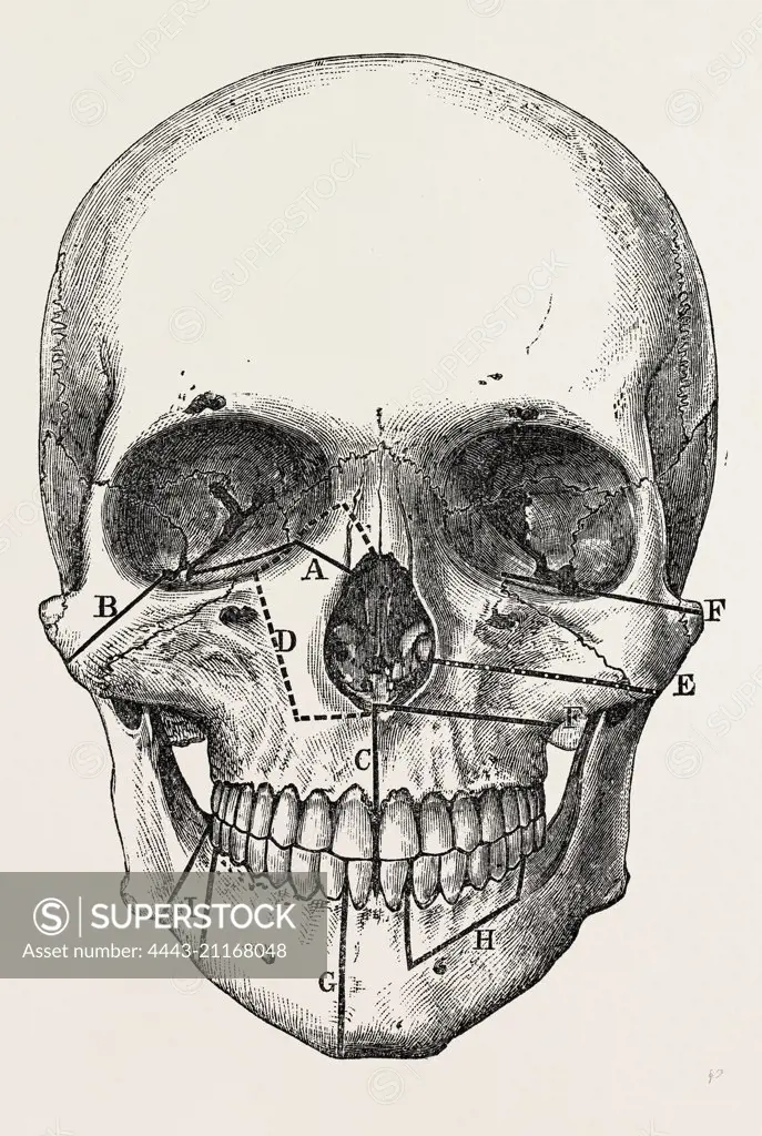 incisions, medical equipment, surgical instrument, history of medicine