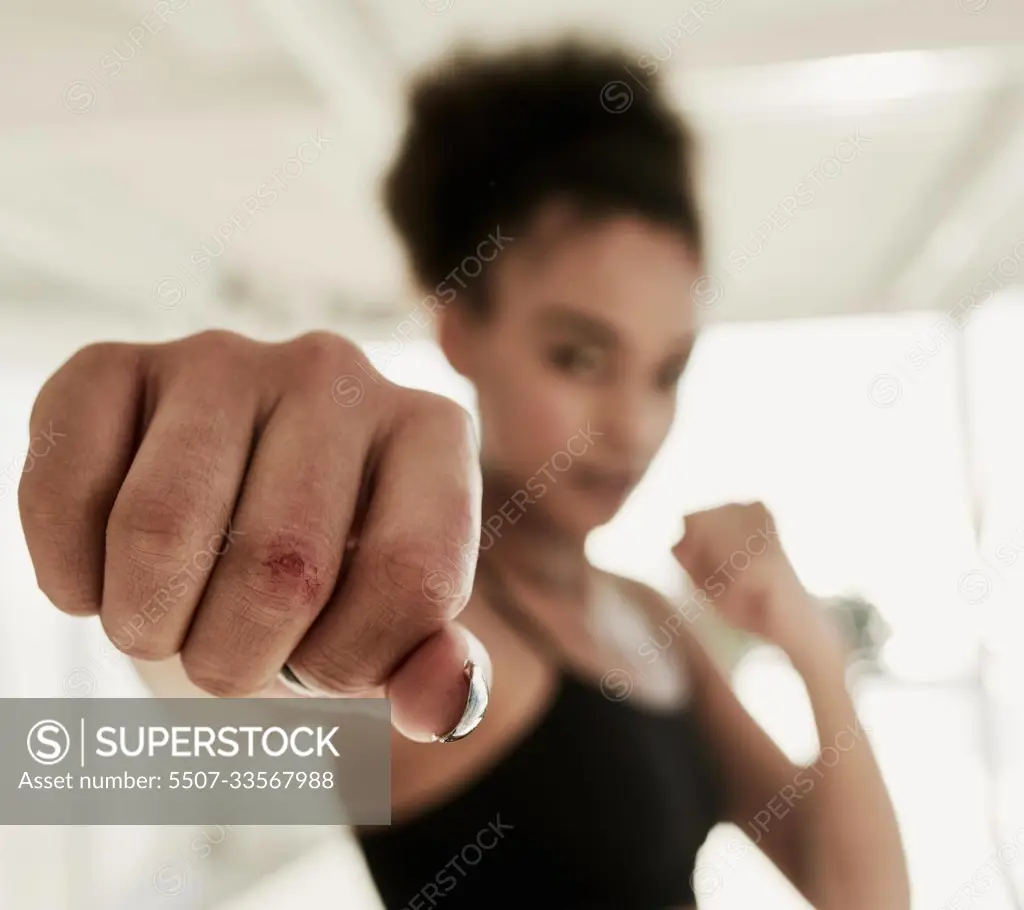 Scars are tattoos with better stories. Closeup shot of a sporty young woman  with a scar on her hand. - SuperStock