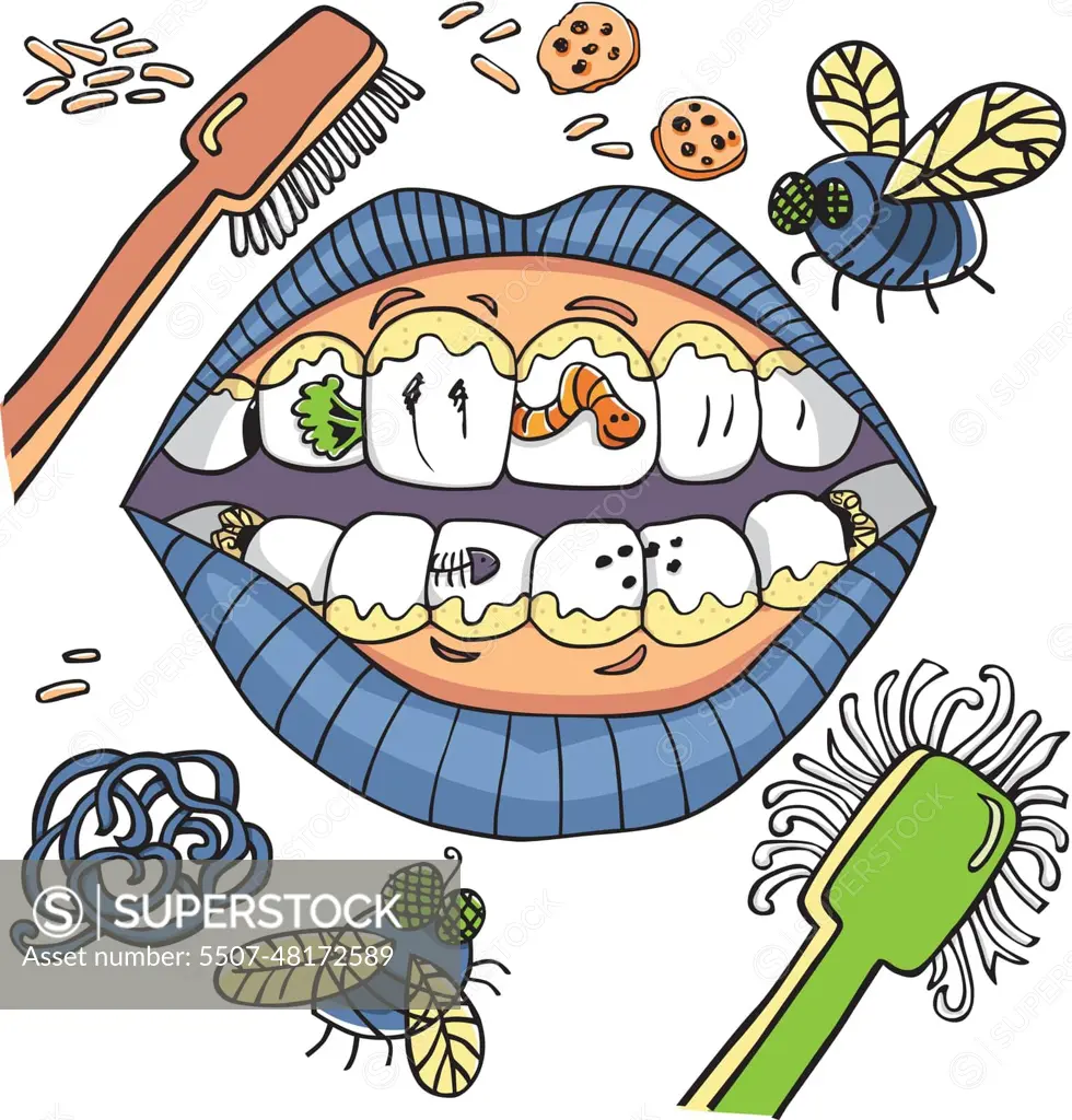 Vector dental hygiene humour with mouth showing dirty teeth with worms and  plaque and vegetables. - SuperStock