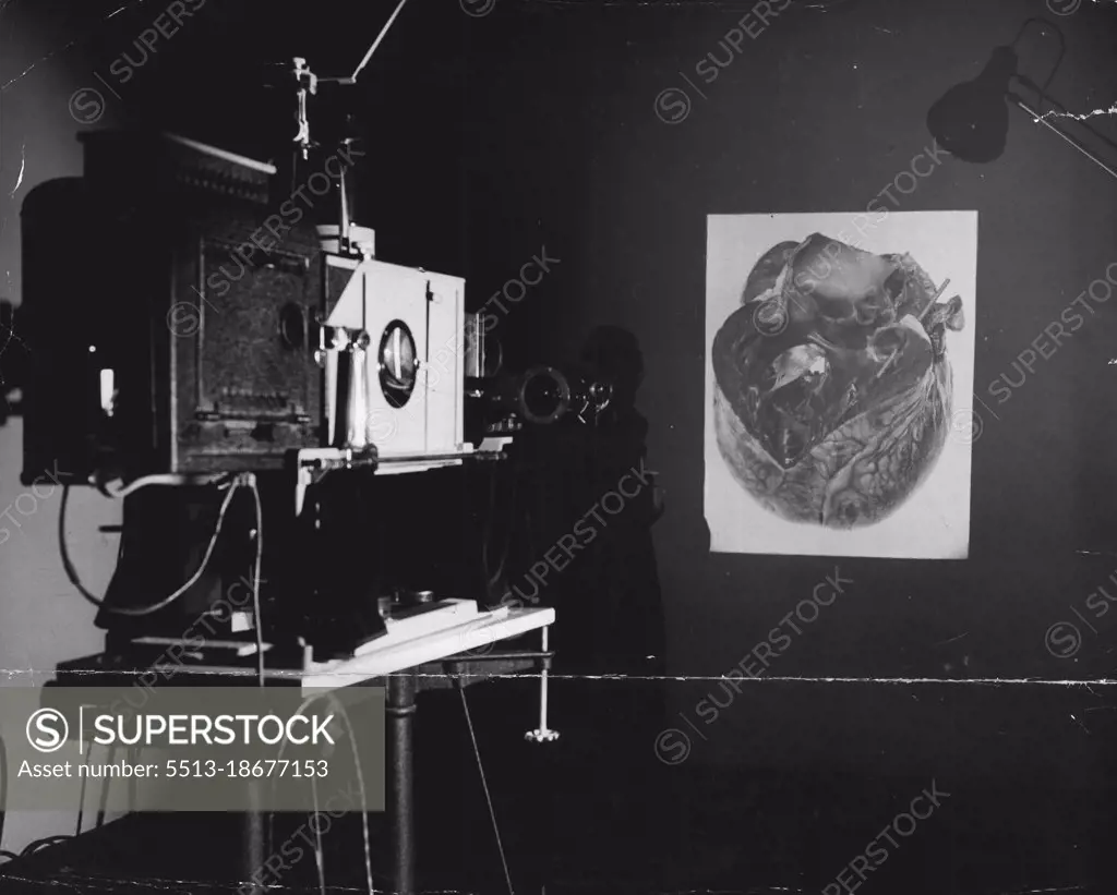 Epidiascope is used to project photographic slides or images of actual speciments on to a screen for lectures. Picture being thrown on to wall here is of a diseased human heart. April 27, 1946.