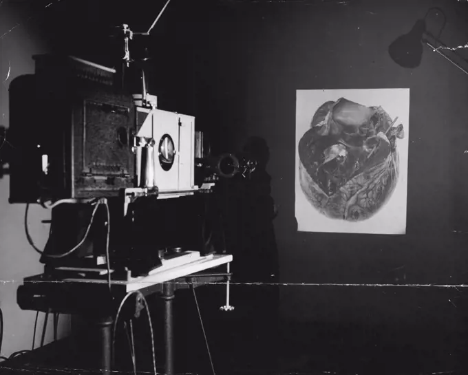 Epidiascope is used to project photographic slides or images of actual speciments on to a screen for lectures. Picture being thrown on to wall here is of a diseased human heart. April 27, 1946.