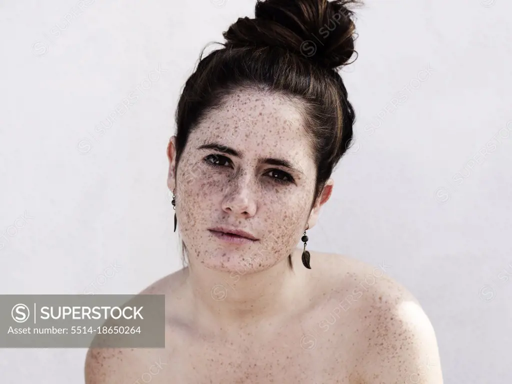 Girl with freckles on face and body