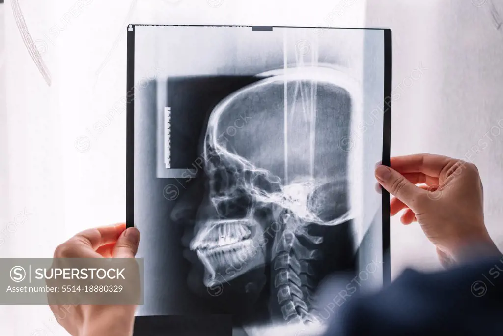 Doctor examining a head x-ray