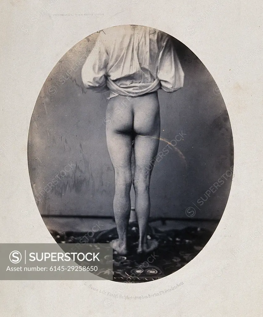 A man, viewed from behind, with naked legs and buttocks. Photograph by L.  Haase after H.W. Berend, 1860. - SuperStock