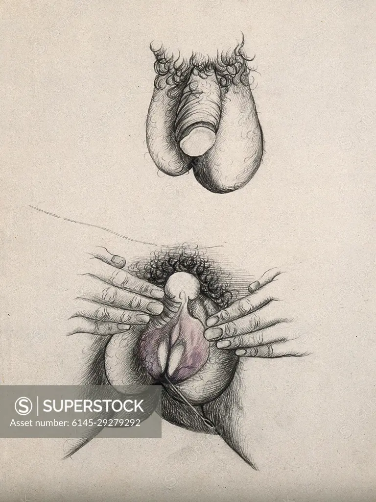 A penis and scrotum; and labia held open by hand with a rod () extending  from the vagina. Coloured drawing. - SuperStock