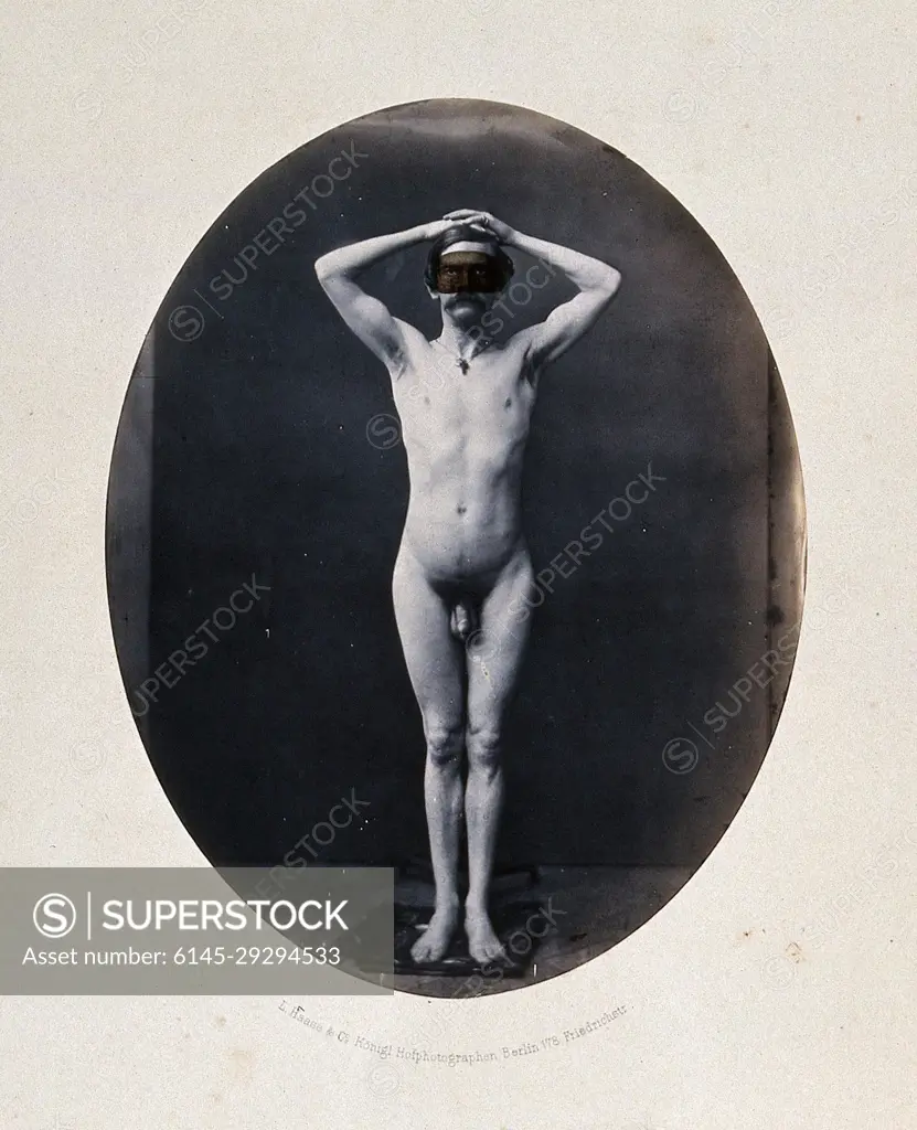 A man standing, naked, full-length, with hands on head. Photograph by L.  Haase after H.W. Berend, 1861. - SuperStock