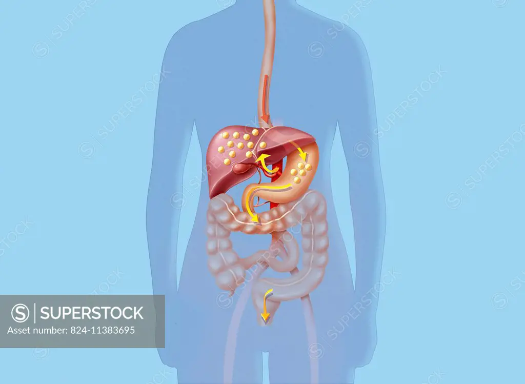 Illustration of the origin of cholesterol and its elimination. The bodys cholesterol is synthesised in the liver (70%), diet does the rest. LDL chole...