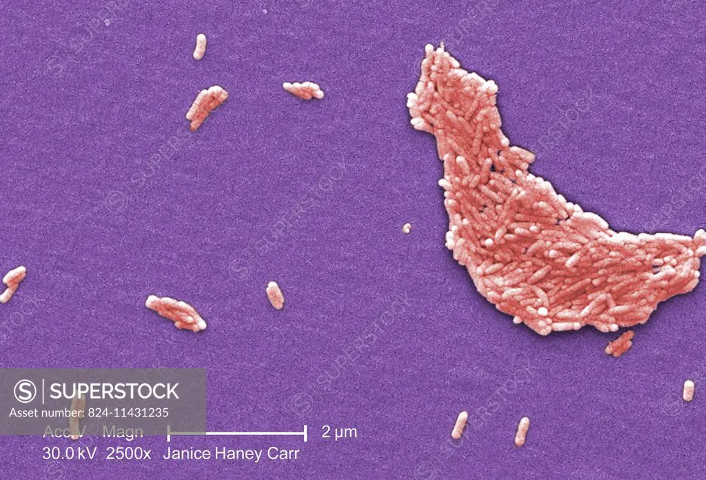 Under a magnification of 2500X, this colorized scanning electron micrograph (SEM) revealed the presence of a large number of Gram-negative Salmonella ...