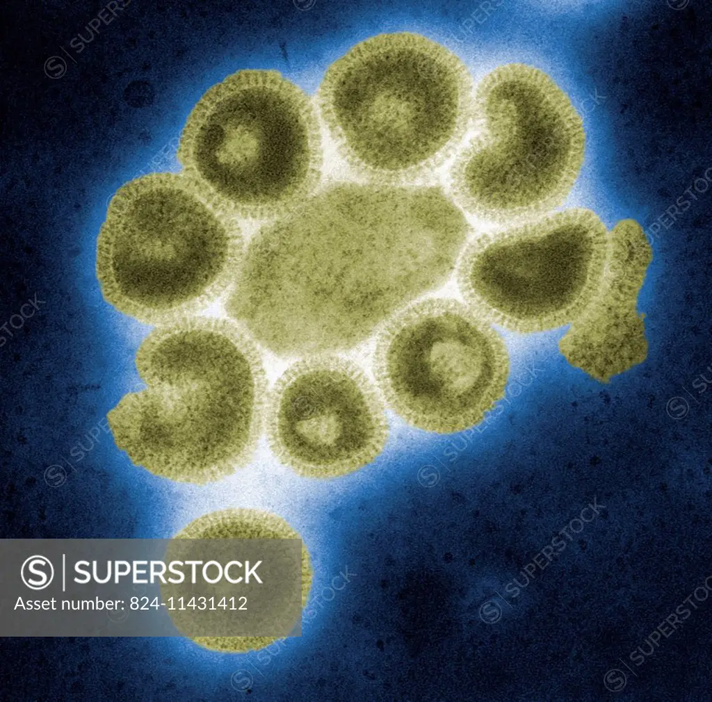 This colorized negative-stained transmission electron micrograph (TEM) depicts the ultrastructural details of a number of influenza virus particles, o...