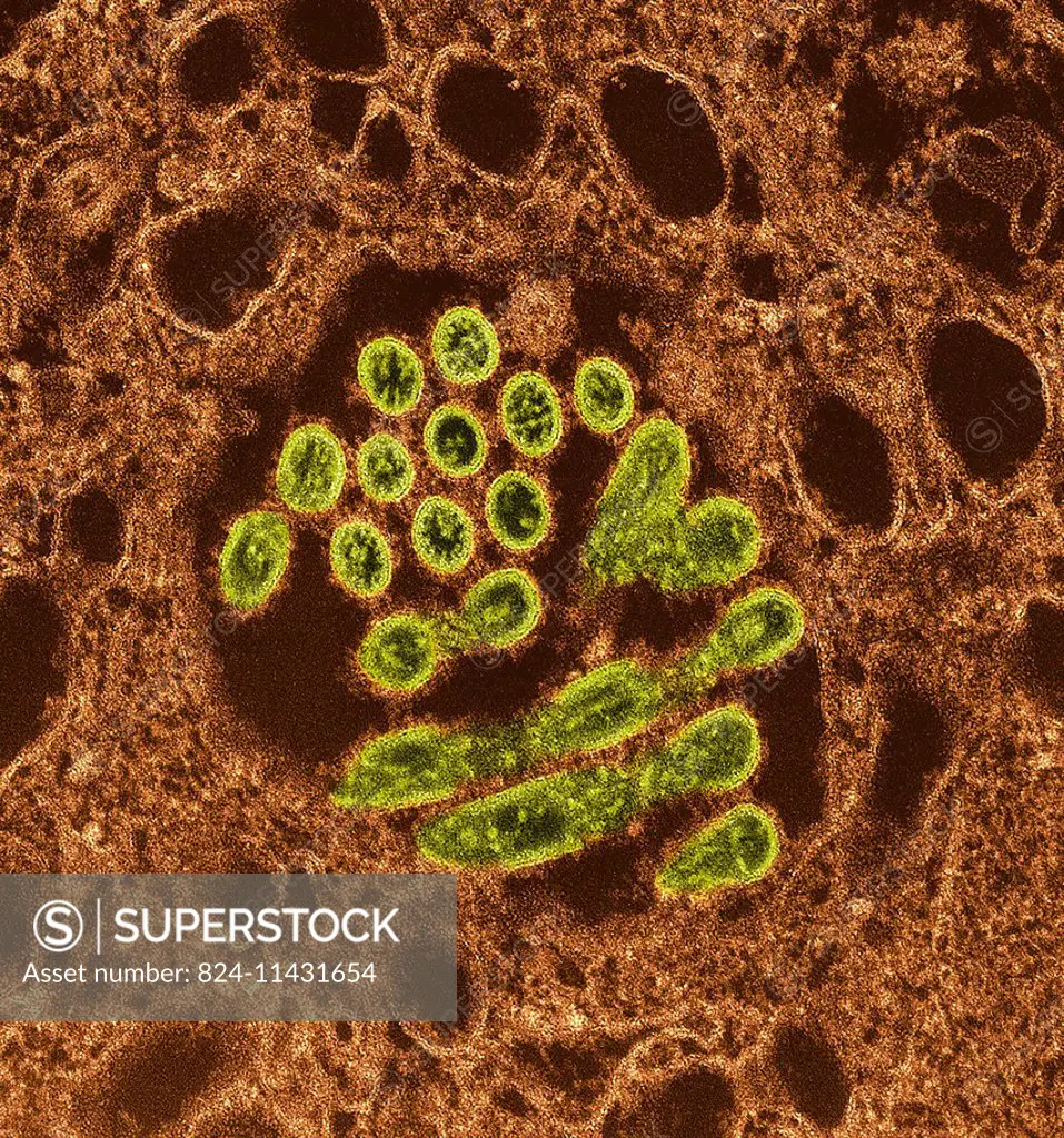 This colorized transmission electron micrograph (TEM) revealed the presence of a number of Novel H1N1 virus virions in this tissue culture sample. Nov...