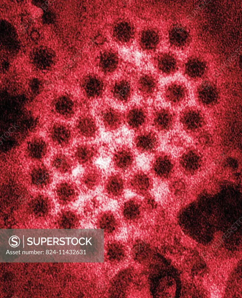 This colorized transmission electron micrograph (TEM) revealed some of the ultrastructural morphology displayed by norovirus virions, or virus particl...