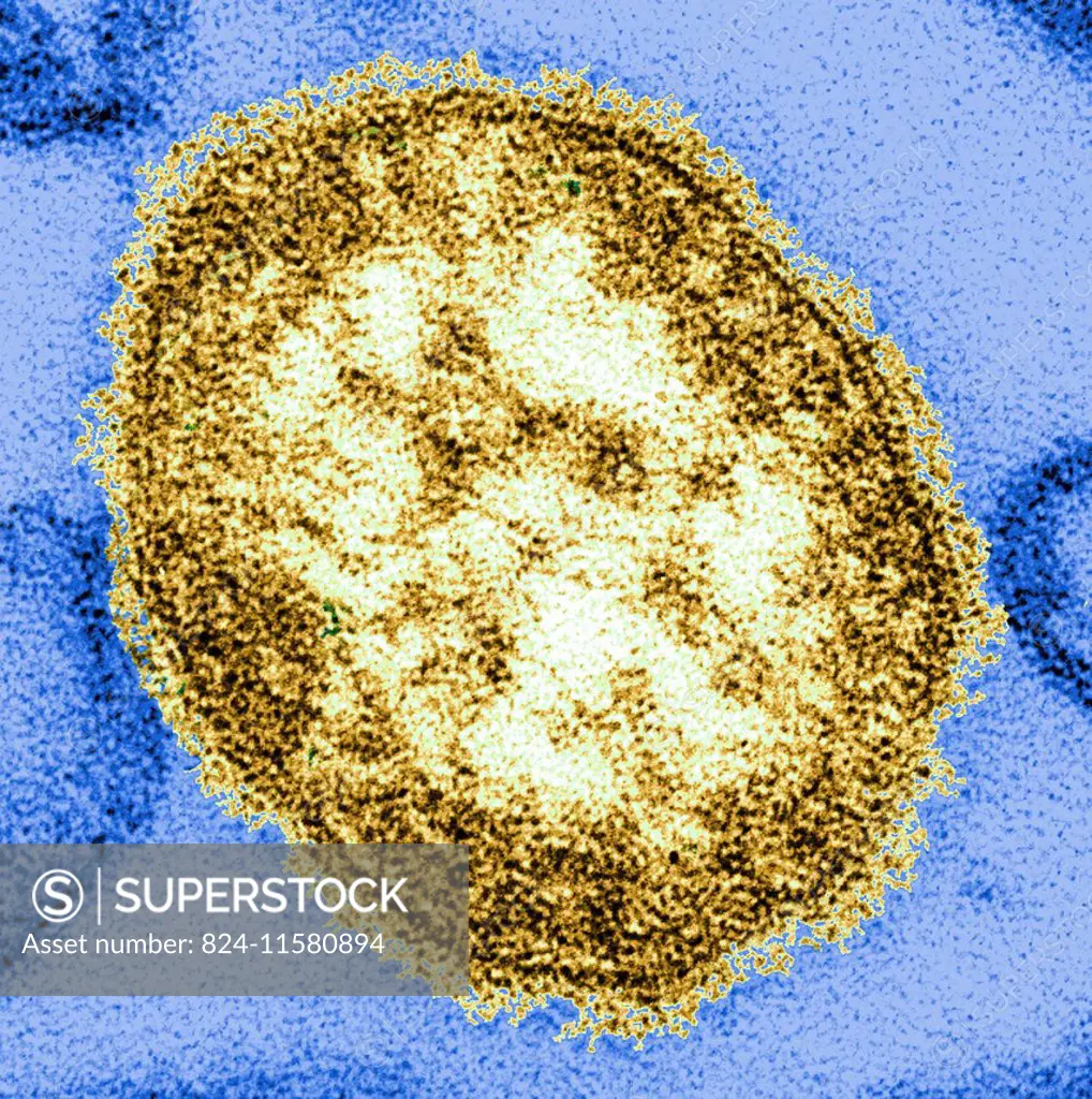 this thin-section transmission electron micrograph (tem) revealed the ultrastructural appearance of a single virus particle, or virion”, of measles v...